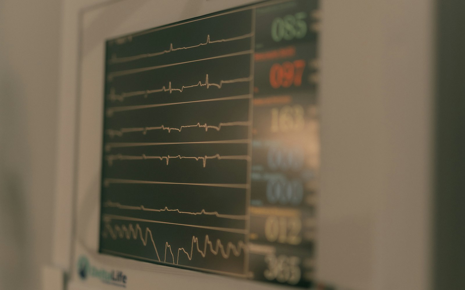 Clinical team performing cardiovascular diagnostic testing